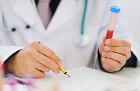 εξετάσεις για προστατίτιδα για τη συνταγογράφηση φαρμάκων